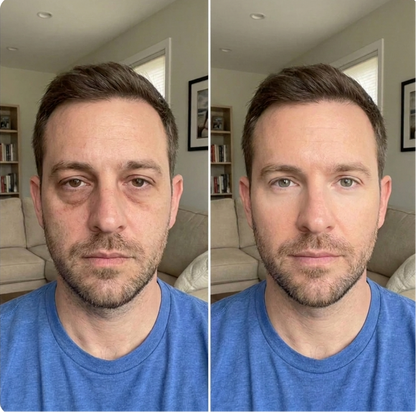 Eye Repair Stick
